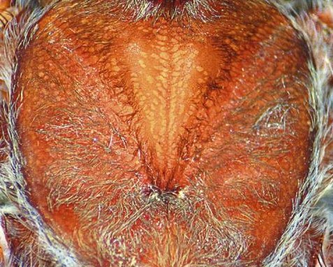 Carapace