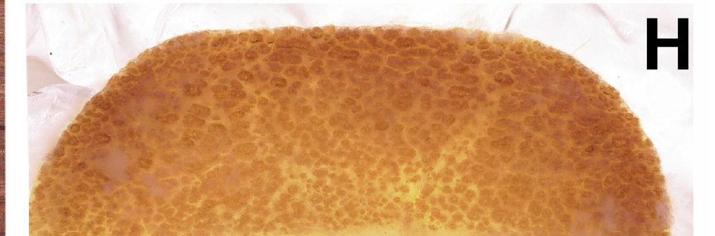 Spermathecae
