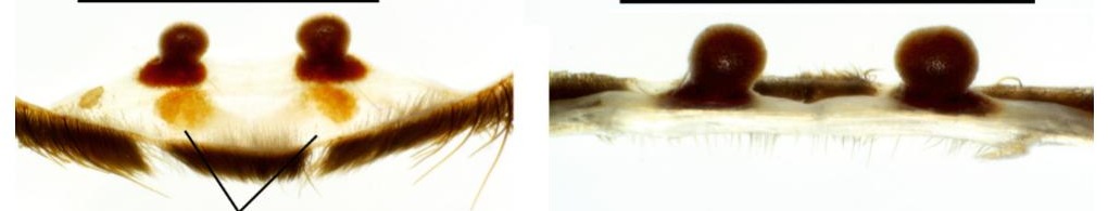 Spermathecae